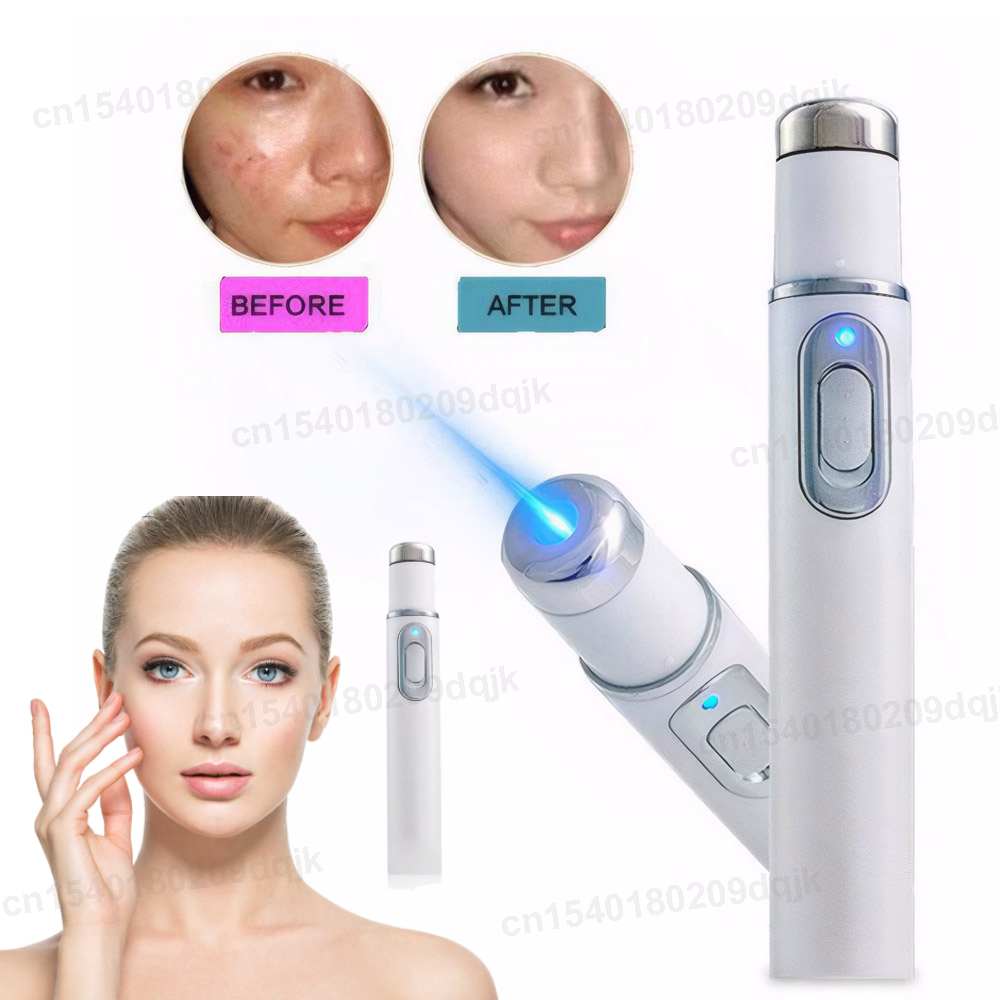 Acne Light Therapy Pen - ปากกาบำบัดแสงสีฟ้า LED ใบหน้าบำบัดด้วยแสงสำหรับรอยแผลเป็นกำจัดริ้วรอยอุปกรณ์การดูแลผิวอุปกรณ์ความงาม